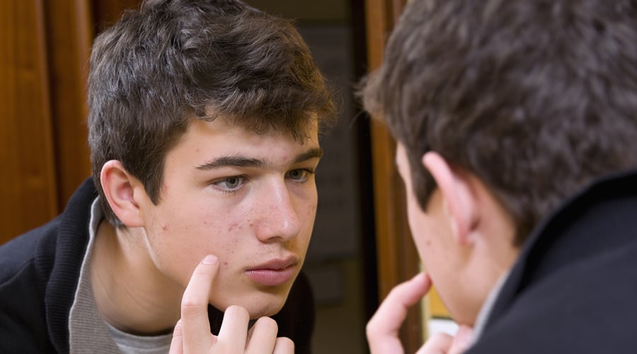 Acne Care for Adolescents