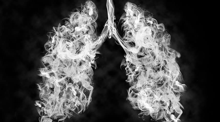 Vaping and Oral Infections, an Increased Risk