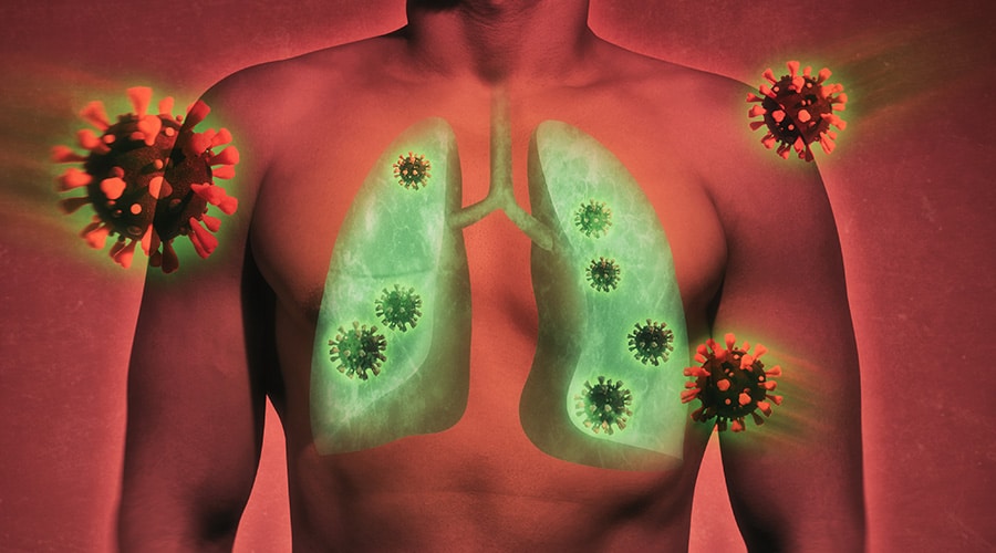 Cytokine Storms Not Causing Lung Damage from COVID-19