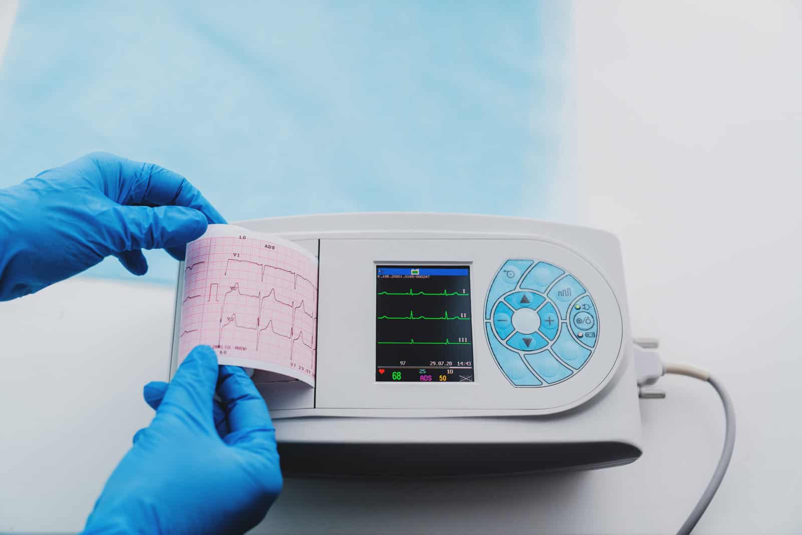 Basic ECG Rhythm Recognition for Nurses