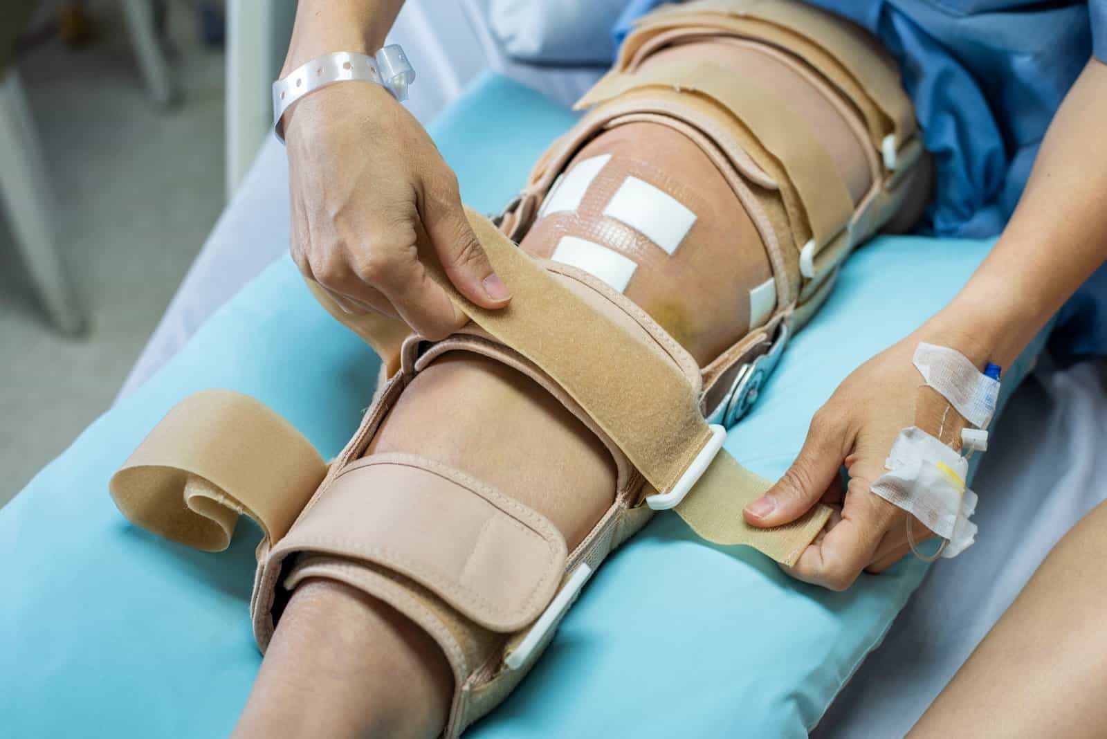 Splinting Techniques for Athletic Trainers and Rehabilitation Professionals